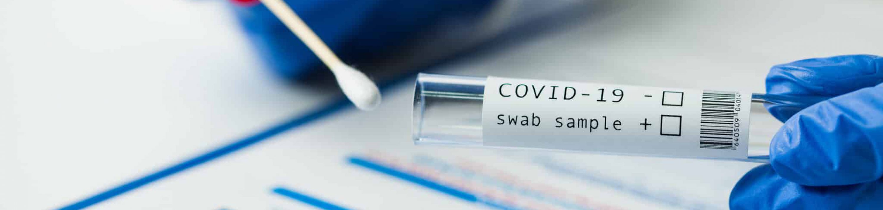 Medical worker holding Coronavirus COVID-19 NP OP swab sample test kit, nasal collection equipment, CDC submitting form, reverse transcription RT-PCR DNA molecular nucleic acid diagnostic procedure